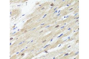 Immunohistochemistry of paraffin-embedded Rat heart using ACSS2 Polyclonal Antibody at dilution of 1:100 (40x lens). (ACSS2 Antikörper)