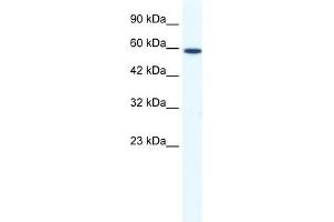 WB Suggested Anti-DDX5 Antibody Titration:  1. (DDX5 Antikörper  (N-Term))