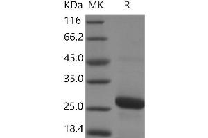 Western Blotting (WB) image for RAB7A, Member RAS Oncogene Family (RAB7A) protein (His tag) (ABIN7321067)