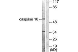 Western blot analysis of extracts from HeLa cells, using Caspase 10 Antibody. (Caspase 10 Antikörper  (AA 430-479))