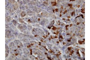 Immunoperoxidase of monoclonal antibody to LAMA2 on formalin-fixed paraffin-embedded human pancreas.