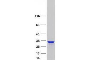 Western Blotting (WB) image for Hydroxysteroid (17-Beta) Dehydrogenase 14 (HSD17B14) protein (Myc-DYKDDDDK Tag) (ABIN2714223)