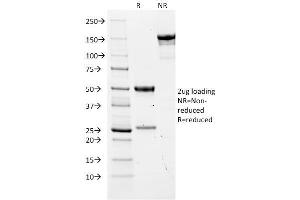 SDS-PAGE Analysis Purified CEA Mouse Monoclonal Antibody (COL-1). (CEACAM5 Antikörper)