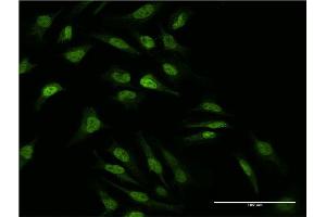 Immunofluorescence of monoclonal antibody to MAP2K2 on HeLa cell. (MEK2 Antikörper  (AA 1-360))