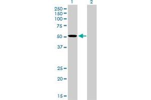 Western Blot analysis of TCF7L2 expression in transfected 293T cell line by TCF7L2 monoclonal antibody (M02), clone 1B1. (TCF7L2 Antikörper  (AA 1-455))