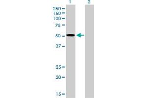 Western Blot analysis of TCF7L2 expression in transfected 293T cell line by TCF7L2 monoclonal antibody (M02), clone 1B1.