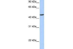 WB Suggested Anti-hCG_20426 Antibody Titration:  0. (ANKRD65 Antikörper  (N-Term))
