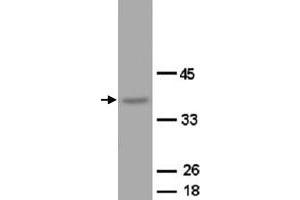 Western Blot analysis of OPCML expression from rat brain tissue lyate with OPCML polyclonal antibody . (OPCML Antikörper  (C-Term))