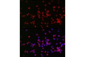 Immunofluorescence analysis of Neuro-2a cells using NOGO Receptor 1 (RTN4R) Rabbit pAb (ABIN6129725, ABIN6147296, ABIN6147297 and ABIN6221547) at dilution of 1:25 (40x lens). (RTN4R Antikörper  (AA 244-473))