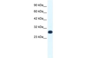 Western Blotting (WB) image for anti-General Transcription Factor IIF, Polypeptide 2, 30kDa (GTF2F2) antibody (ABIN2460223)