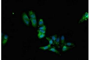 Immunofluorescent analysis of Hela cells using ABIN7169242 at dilution of 1:100 and Alexa Fluor 488-congugated AffiniPure Goat Anti-Rabbit IgG(H+L) (PPP2R2A Antikörper  (Regulatory Subunit B))