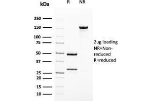 SDS-PAGE Analysis Purified Uroplakin 1B Mouse Monoclonal Antibody (UPK1B/3102). (Uroplakin 1B Antikörper  (AA 109-229))