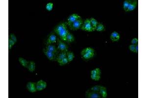 Immunofluorescence staining of HepG2 cells with ABIN7142343 at 1:133, counter-stained with DAPI. (ERI1 Antikörper  (AA 2-66))