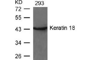 Image no. 2 for anti-Keratin 18 (KRT18) (AA 31-35) antibody (ABIN197581) (Cytokeratin 18 Antikörper  (AA 31-35))