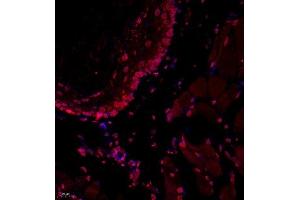 Immunofluorescence of paraffin embedded mouse esophagus using USP34 (ABIN7076115) at dilution of 1:700 (400x lens)