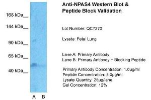 Host:  Rabbit  Target Name:  NPAS4  Sample Type:  Fetal Lung  Lane A:  Primary Antibody  Lane B:  Primary Antibody + Blocking Peptide  Primary Antibody Concentration:  1ug/ml  Peptide Concentration:  5ug/ml  Lysate Quantity:  25ug/lane/Lane  Gel Concentration:  0. (NPAS4 Antikörper  (Middle Region))