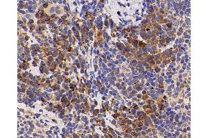 Immunohistochemistry analysis of paraffin-embedded mouse inflammatory spleen using IL2 Polyclonal Antibody at dilution of 1:500. (IL-2 Antikörper)
