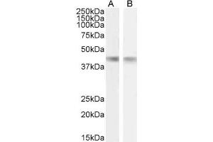 ABIN1590065 (1µg/ml) staining of Mouse (A) and Rat (B) Heart lysate (35µg protein in RIPA buffer). (CKM Antikörper  (AA 258-270))