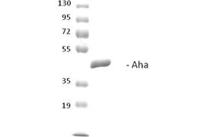SDS-PAGE of ~38 kDa his-tagged yeast Aha1 protein (ABIN1686741, ABIN1686742 and ABIN1686743).
