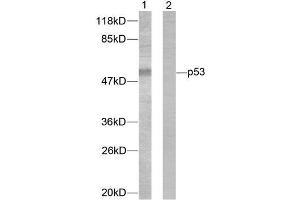 Western blot analysis of extracts from 293 cells treated with (p53 Antikörper)