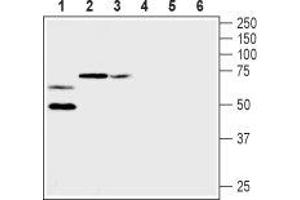 Western Blotting (WB) image for anti-Potassium Voltage-Gated Channel, Shaker-Related Subfamily, Member 2 (KCNA2) (AA 189-201), (Extracellular) antibody (ABIN7043518)