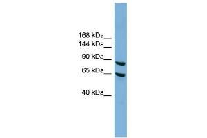 EXOC6 antibody used at 1 ug/ml to detect target protein. (EXOC6 Antikörper  (N-Term))