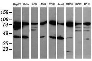 Image no. 1 for anti-Catenin (Cadherin-Associated Protein), beta 1, 88kDa (CTNNB1) antibody (ABIN1496898) (CTNNB1 Antikörper)