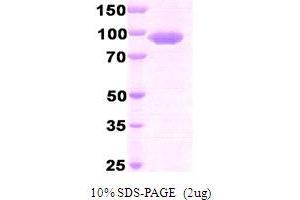 SDS-PAGE (SDS) image for Dipeptidyl-Peptidase 4 (DPP4) (AA 39-766) protein (His tag) (ABIN666712) (DPP4 Protein (AA 39-766) (His tag))
