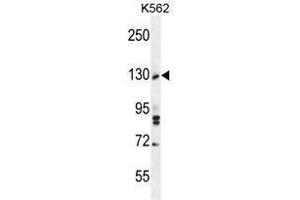 TTBK2 Antibody (N-term) western blot analysis in K562 cell line lysates (35 µg/lane).