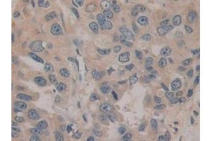 Immunohistochemistry (IHC) image for anti-Glutamyl Aminopeptidase (Aminopeptidase A) (ENPEP) (AA 718-948) antibody (ABIN7443356)