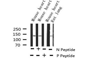 Western blot analysis of Phospho-Abl (Tyr412) expression in various lysates (ABL1 Antikörper  (pTyr412))