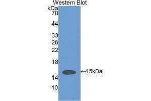 Western Blotting (WB) image for anti-Vinculin (VCL) (AA 1020-1134) antibody (ABIN1175095) (Vinculin Antikörper  (AA 1020-1134))
