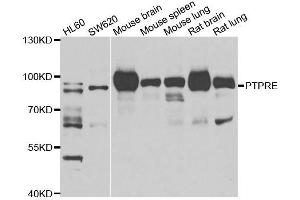 PTPRE Antikörper  (AA 20-200)