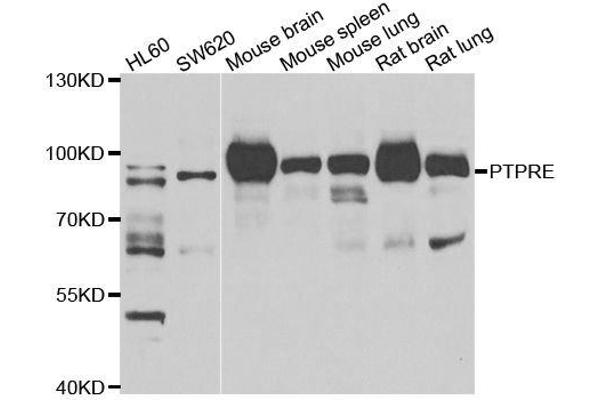 PTPRE Antikörper  (AA 20-200)