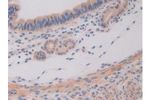 Immunohistochemistry (IHC) image for anti-Interleukin 11 Receptor, alpha (IL11RA) (AA 194-329) antibody (ABIN7438169)