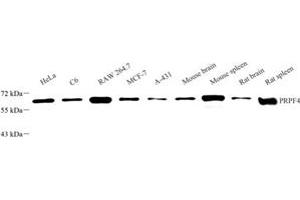 Western blot analysis of PRPF4 (ABIN7075312) at dilution of 1: 500 (PRPF4 Antikörper)