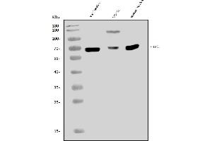 Western blot analysis of PAK1 using anti-PAK1 antibody (ABIN7600479).
