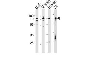 Western Blotting (WB) image for anti-Far Upstream Element (FUSE) Binding Protein 1 (FUBP1) antibody (ABIN2997751) (FUBP1 Antikörper)