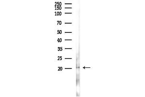 anti-Tumor Protein P53 Inducible Protein 11 (TP53I11) (N-Term) antibody