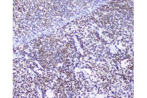 IHC analysis of AHR using anti-AHR antibody (ABIN6719265). (Aryl Hydrocarbon Receptor Antikörper)