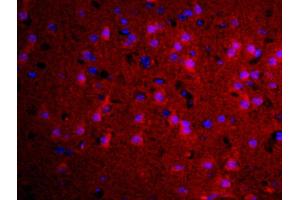 Formalin-fixed and paraffin embedded rat brain labeled with Rabbit Anti-TGM2 Polyclonal Antibody, Unconjugated used at 1:200 dilution for 40 minutes at 37°C (Transglutaminase 2 Antikörper  (AA 551-650))