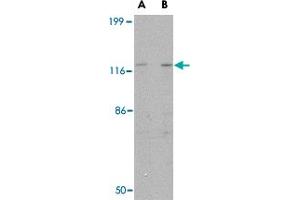Western blot analysis of SLITRK3 in SK-N-SH cell lysate with SLITRK3 polyclonal antibody  at (A) 0. (SLITRK3 Antikörper  (C-Term))
