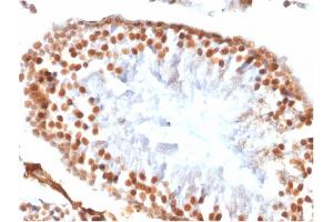 Formalin-fixed, paraffin-embedded Rat Testis stained with Wilm's Tumor Rabbit Recombinant Monoclonal Antibody (WT1/1434R). (Rekombinanter WT1 Antikörper)