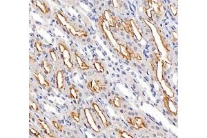 Immunohistochemistry of paraffin embedded mouse kidney using ADCY4 (ABIN7072959) at dilution of 1: 700 (400x lens)