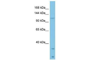 Laminin Beta 3 antibody used at 1 ug/ml to detect target protein. (Laminin beta 3 Antikörper  (Middle Region))