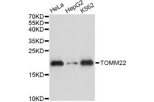 Western blot analysis of extracts of various cell lines, using TOMM22 antibody. (TOMM22 Antikörper)