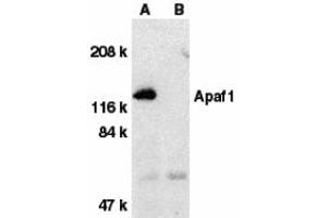 Western Blotting (WB) image for anti-Apoptotic Peptidase Activating Factor 1 (APAF1) (C-Term) antibody (ABIN1030242) (APAF1 Antikörper  (C-Term))