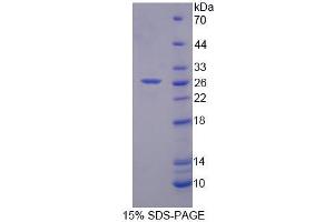 SDS-PAGE analysis of Human RFC4 Protein.