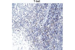Immunohistochemistry (Paraffin-embedded Sections) (IHC (p)) image for anti-T-Bet antibody (ABIN967672)