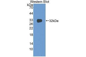 Western Blotting (WB) image for anti-Coagulation Factor III (thromboplastin, Tissue Factor) (F3) (AA 30-251) antibody (ABIN7427675)